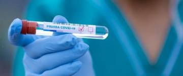 Curva en ascenso: confirmaron hoy 535 nuevos casos de coronavirus en Salta